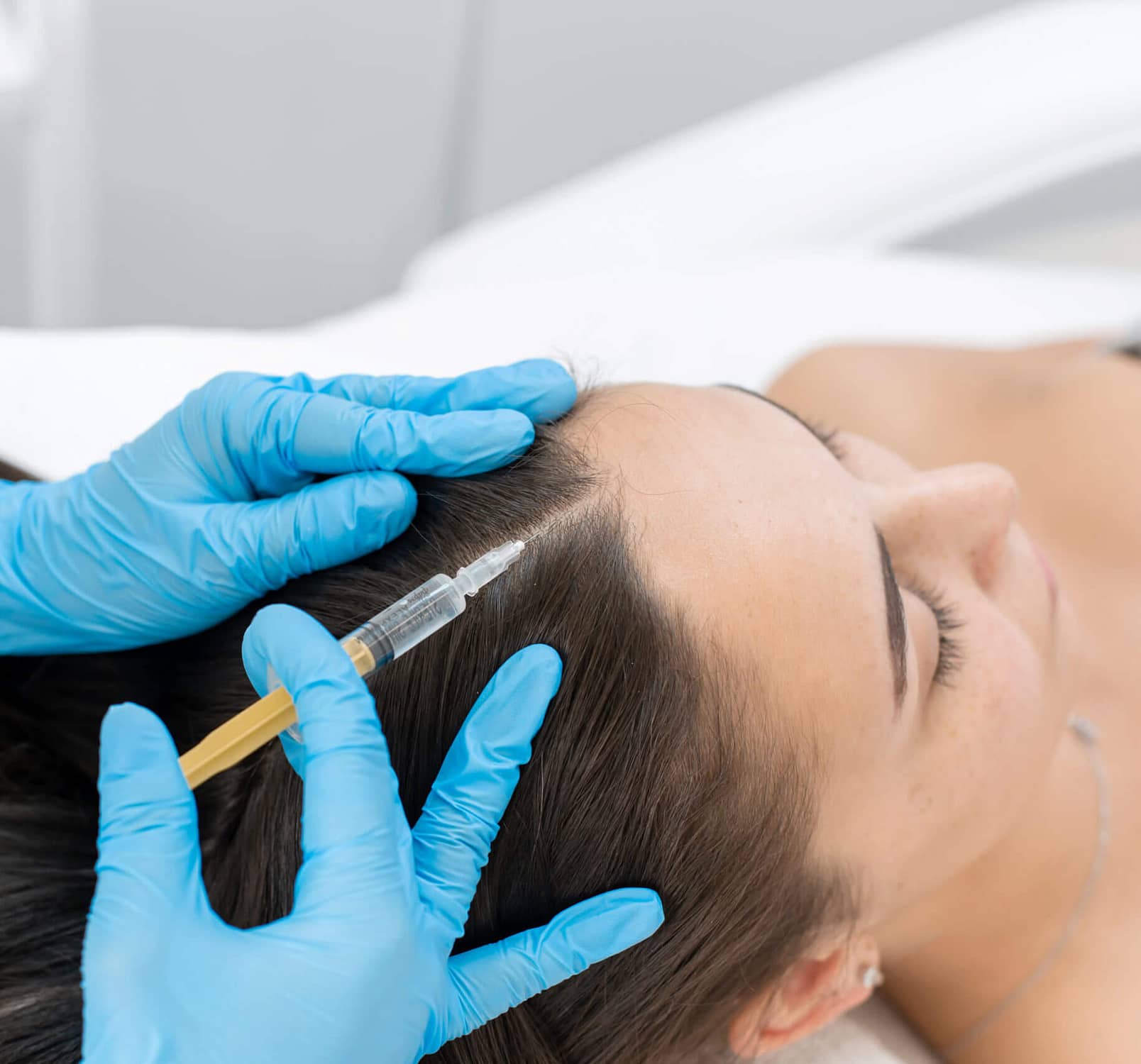 Best PRP Hair Loss Treatment Toronto | PRP Hair Restoration