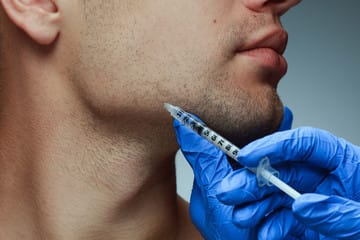 Brotox botox injectables in Etobicoke for men