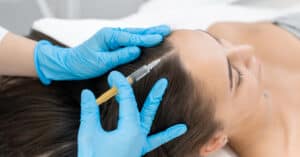 Hair Restoration treatment