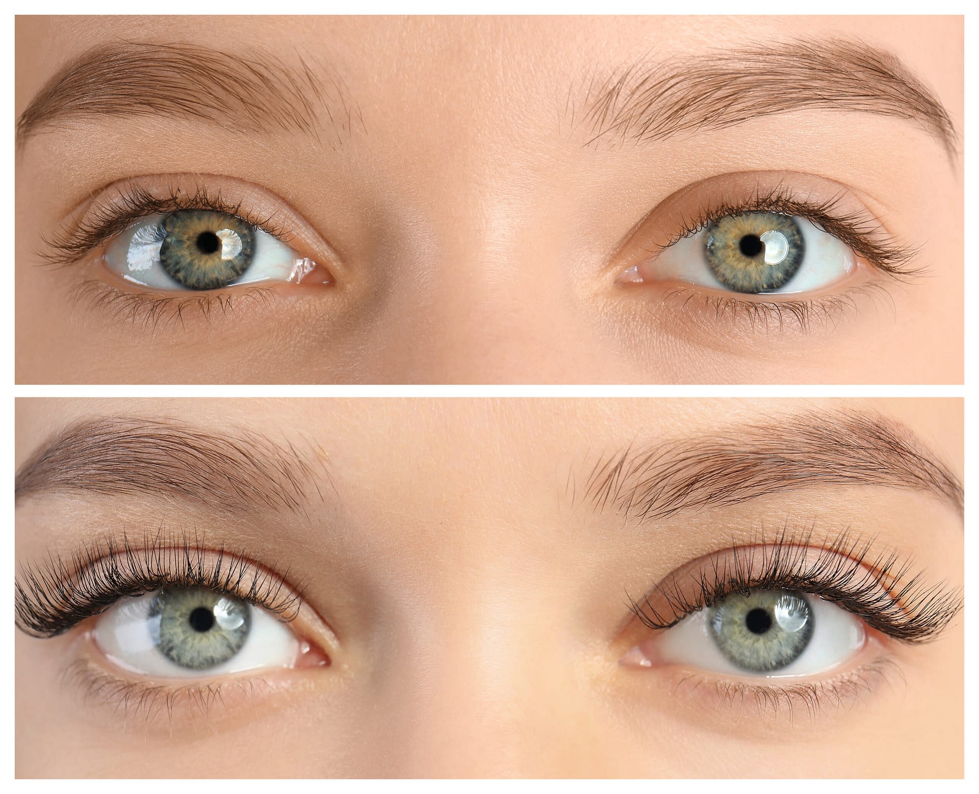 Latisse Eyelash Growth Treatment Let Them Notice